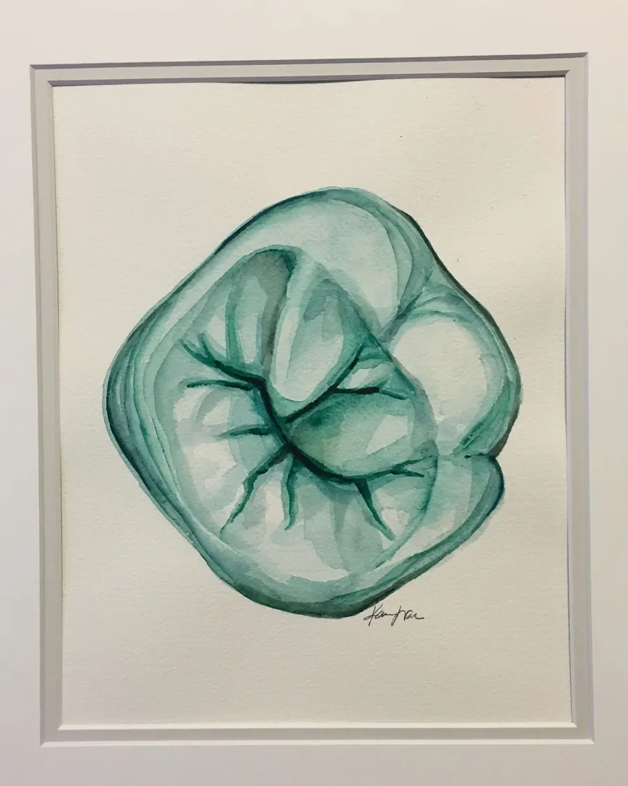 A watercolour of a molar, one of the paintings on the office walls.